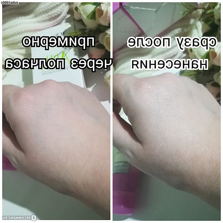 Аллергическая реакция у детей на руках