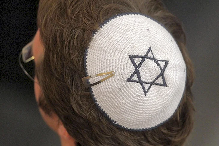 Еврейская шапочка на макушке