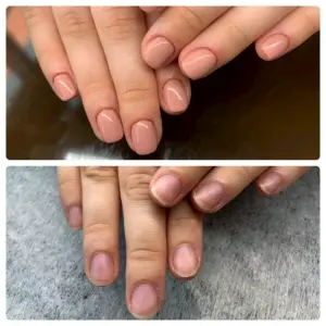 Ногти до и после